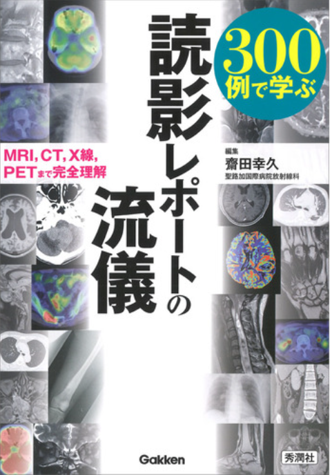 300例で学ぶ 読影レポートの流儀: MRI、CT、X線、PETまで完全理解
					齋田幸久 (編集)　